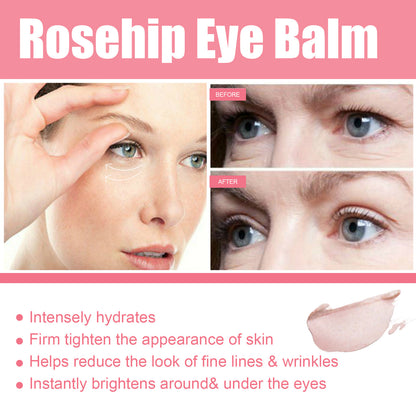 Women Extra Renewing Rosehip Eye Balm for Face Lifting