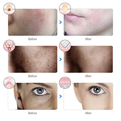 7-Color LED Light Therapy Face Mask – Rechargeable Photon Skin Rejuvenation & Anti-Aging Beauty Mask