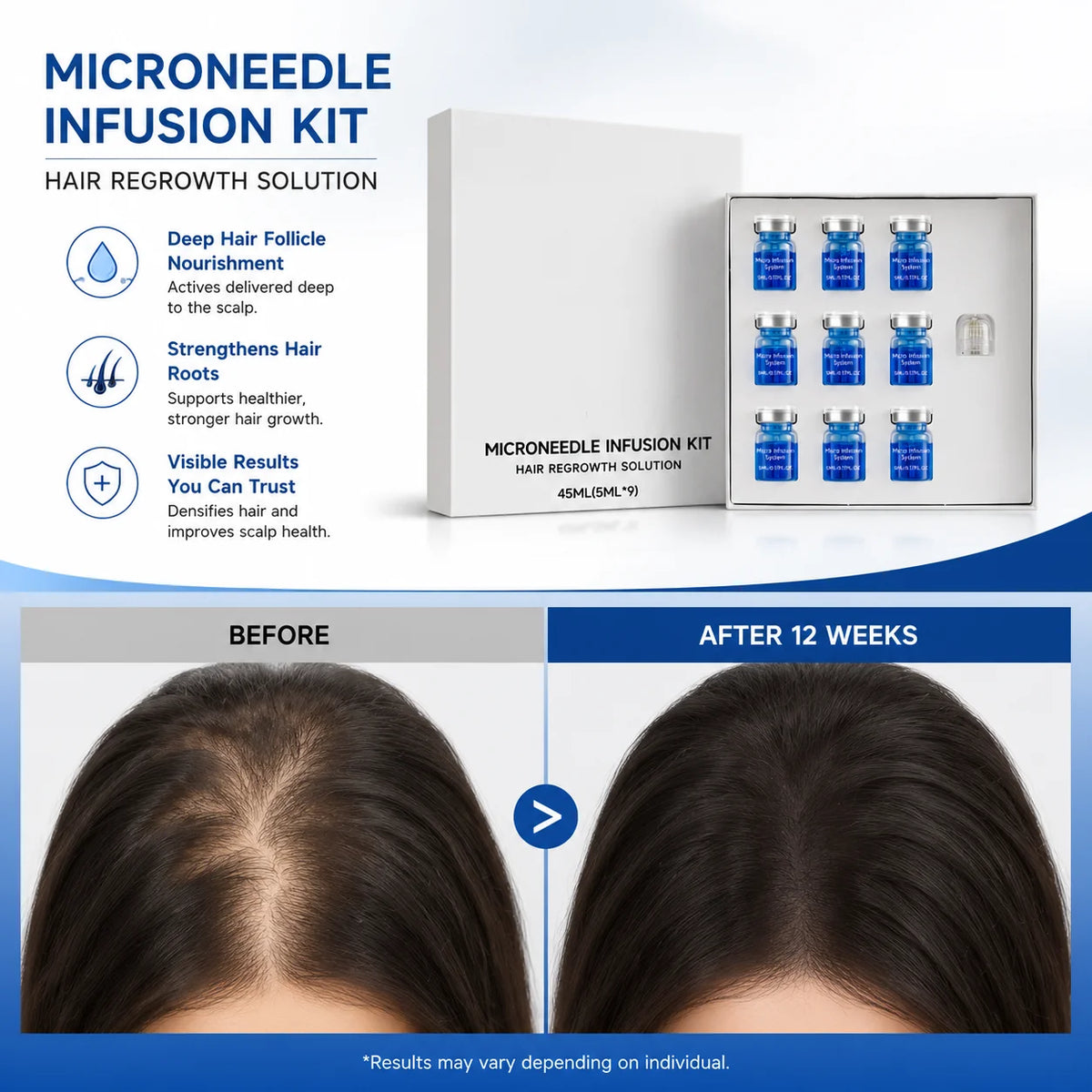 Microneedle Scalp Care Kit with Hair Serum