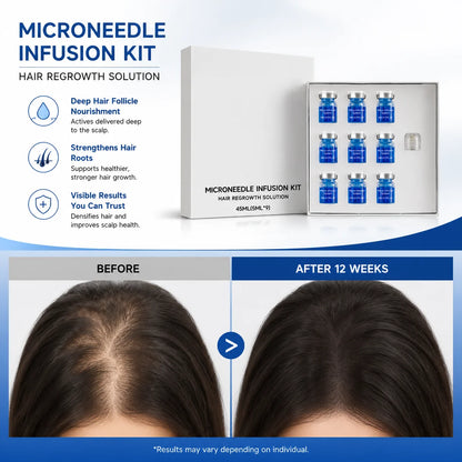 Microneedle Scalp Care Kit with Hair Serum