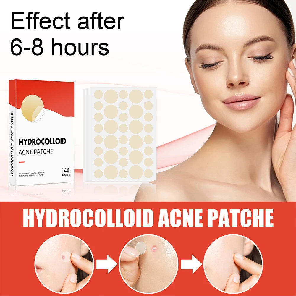 144pcs Hydrocolloid Acne Pimple Patches – 2 Sizes, Invisible Spot Stickers for Face Skin Care | Men & Women