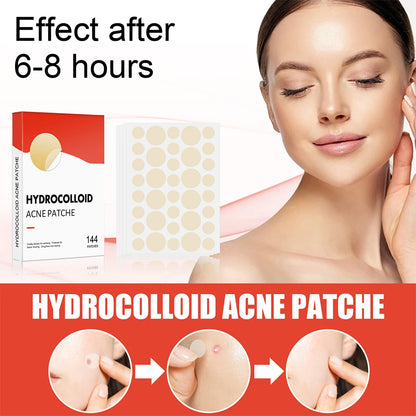 144pcs Hydrocolloid Acne Pimple Patches – 2 Sizes, Invisible Spot Stickers for Face Skin Care | Men & Women