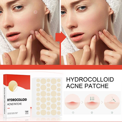144pcs Hydrocolloid Acne Pimple Patches – 2 Sizes, Invisible Spot Stickers for Face Skin Care | Men & Women