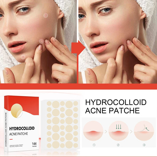144pcs Hydrocolloid Acne Pimple Patches – 2 Sizes, Invisible Spot Stickers for Face Skin Care | Men & Women